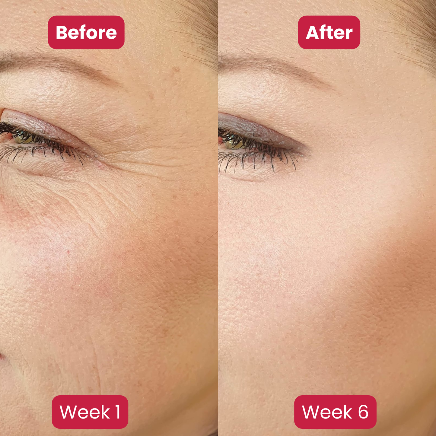 Madeca Barrier Recovery Cream™