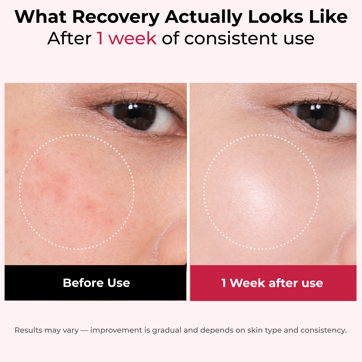 Madeca Barrier Recovery Cream™