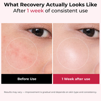 Madeca Barrier Recovery Cream™